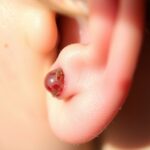 remove piercing for health