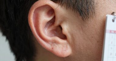 ear healing process timeline