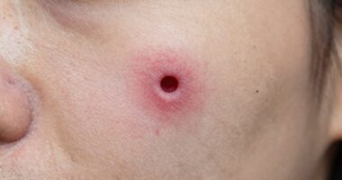 healing process and care