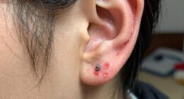 piercing reactions vary naturally