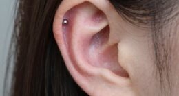 popular cartilage placement trend