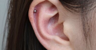 popular cartilage placement trend