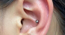 smooth pain free open healed