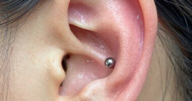 smooth pain free open healed