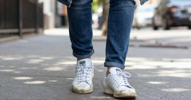 Even With Cracked Leather, Adidas’ Stan Smith Remains Timeless